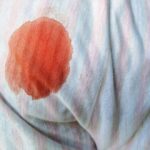 Técnicas de limpieza para remover manchas de sangre en superficies